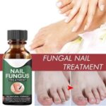 Nail Fungus Treatment Serum