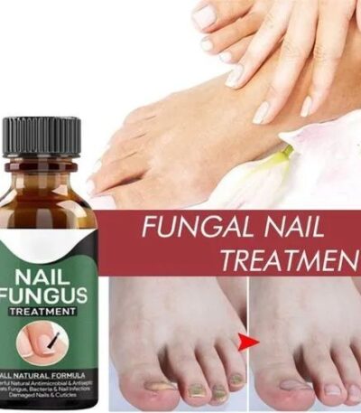 Nail Fungus Treatment Serum