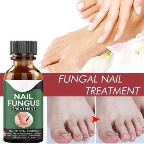 Nail Fungus Treatment Serum